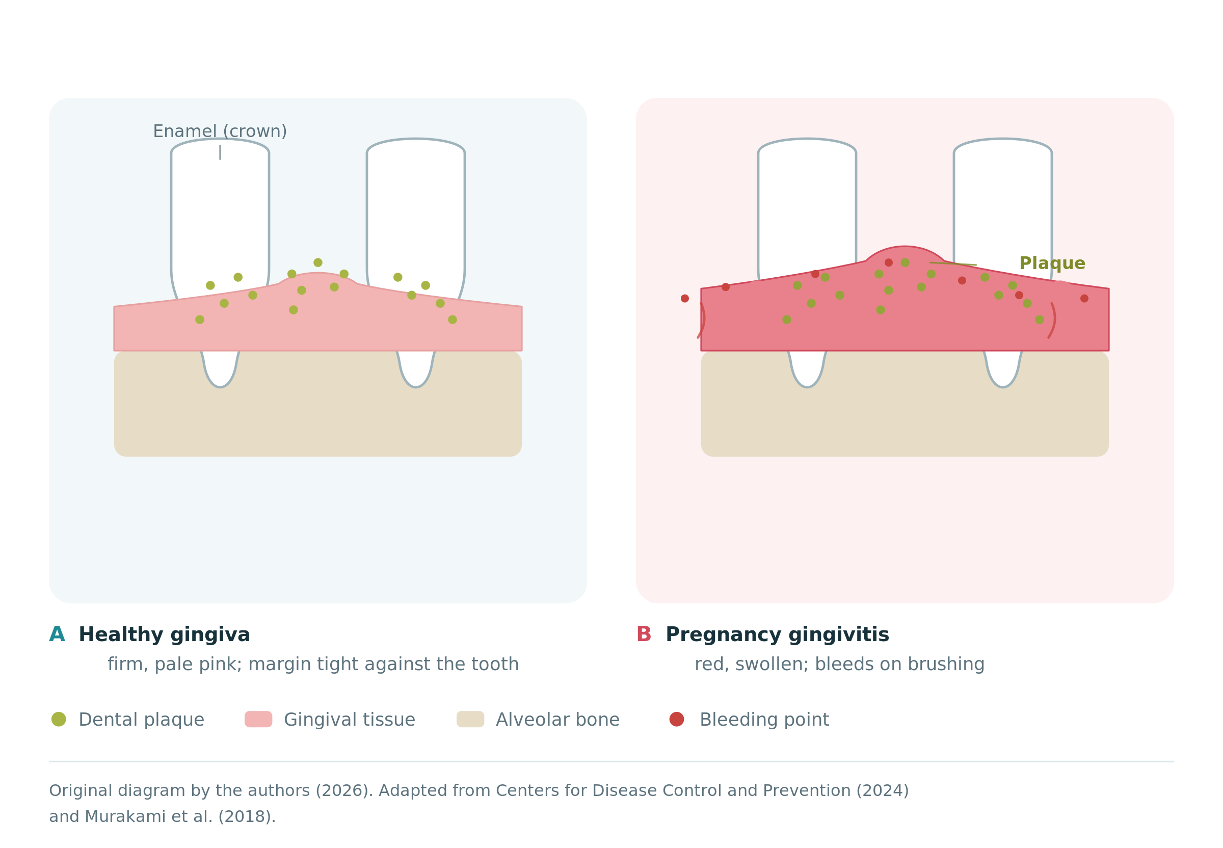 fig2_gingiva_vs_gingivitis.png